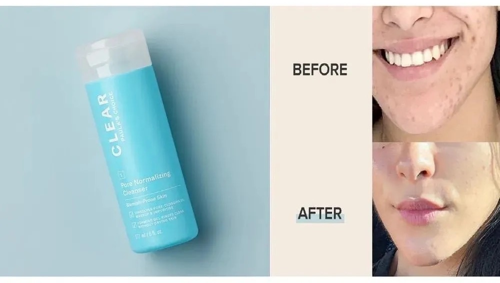 Paula's Choice Clear Pore Normalizing пенка 177 мл
